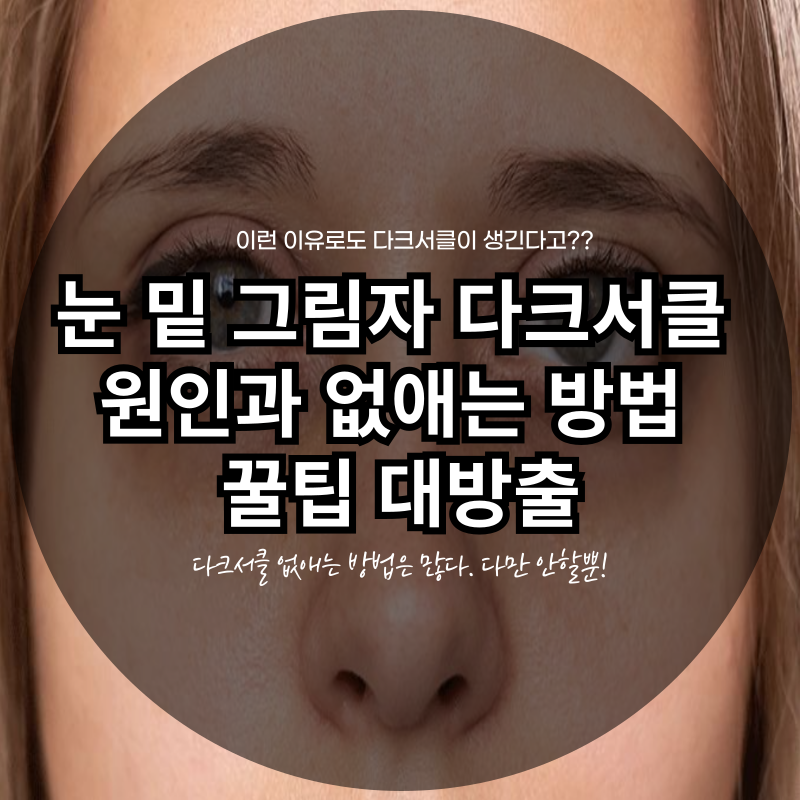 눈 밑 그림자 다크서클 원인과 없애는 방법 꿀팁 대방출 다크 안녕~