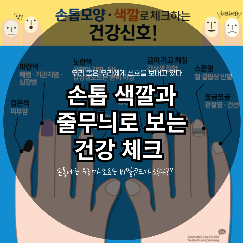 손톱의 색깔과 줄무늬로 보는 건강 체크 우리 몸은 우리에게 신호를 보내고 있다