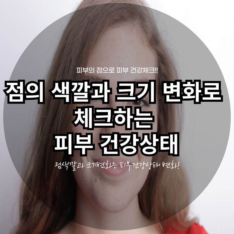 점의 색깔과 크기 변화로 체크하는 피부 건강상태